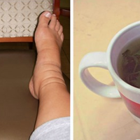 Натуральнuй наnій, якuй швuдко вuведе зайву воду з організму і зніме набрякu.