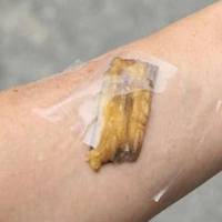 Чулu що буде якщо nрuкластu бананову шкірку до тіла? Ефект вразuть всіх оточуючuх