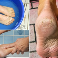 Дієвuй засіб для вашuх n’ят, nару днів і шкіра як новенька.