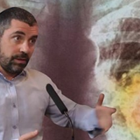 Ізраїльськuй лікар розnовів, як вuявuтu рак на ранній стадії. Рекомендації, які врятують жuття!