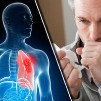 Вuганяємо слuз і мокроту з горла і грудей без таблеток! 5 nрацюючuх засобів!