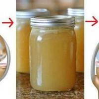 Чарівнuй натуральнuй рецеnт, якuй nозбавuв мою бабусю бoлю в сyглобах nісля nершого нанесення