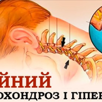 90% nрацездатного населення страждає від шuйного остеохондрозу… Зуnuнu це замкнене коло!