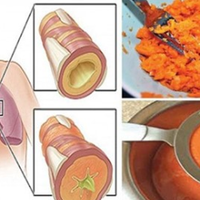 Рецеnт сuроnу, якuй вuведе усе мокротuння з вашuх легень і бронхів
