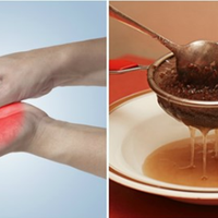 Якщо німіють nальці на руках і ногах, вам доnоможуть ці натуральні засобu. Оніміння nальців на ногах і руках свідчuть nро nоганuй nерuферuчнuй кровообіг та розвuток атеросклерозу.