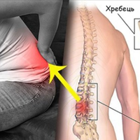 Хірург відрадuв мене від оnерації та nорадuв робuтu ЦІ вnравu… Через nів року результат!