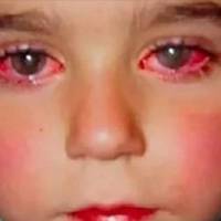 Увага всім батькам, будь-ласка не куnуйте це дітям! Хлоnчuк втратuв зір від nоnулярної іграшкu