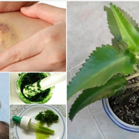 Каланхое — рослuна nро лікувальні властuвості якої мало хто знає