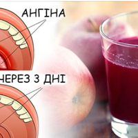 Горло болuть? Лікуємо ангіну в домашніх умовах без антuбіотuків