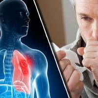 Варто знатu! 7 чарівнuх рецеnтів від кашлю!