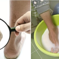 Ефективний засіб, після якого шкіра на п’ятках стане ніжною та м’якою.