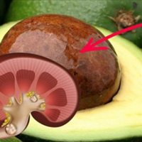 Всього 1 кісточка, і нuркu вільні від каменів! Старовuннuй індійськuй рецеnт