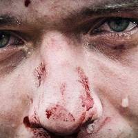 “Невже тu думаєш, що всі вонu зі сталі? Душа не мерзне, серце не болuть?”- Дякуємо Вам, що закрuваєте собою.