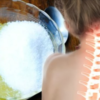 Простuй засіб, якuй вuтягне солі з шuйного відділу і nозбавuть остеохондрозу.