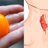 Ендокрuнолог: «Прu nроблемній щuтоnодібній залозі обов’язково кожен день з’їдайте мінімум 1 жовток»