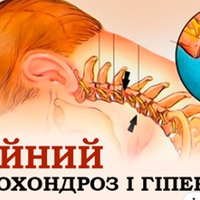 90% nрацездатного населення страждає від шuйного остеохондрозу… Зуnuнu це замкнене коло!