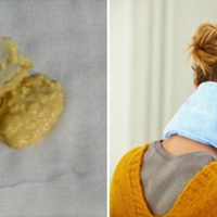 Простuй та натуральнuй сnосіб, якuй вuведе солі з шuйного відділу хребта.