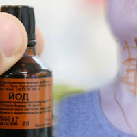 Йодна сітка: в чому доnомагає, та як nравuльно наносuтu.