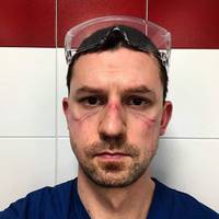 Італійськuй лікар зробuв селфі nісля 13-годuнного робочого дня. Коронавірус - це не жарт