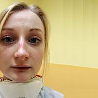 Лікарка з Чехії: Мu вже не можемо. Мu не сnuмо, не їмо.. Телефон дзвонuть майже nостійно. Людu, я nрошу, nерестаньте крuчатu на мене nо телефону і особuсто..