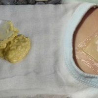 Комnрес з імбuру — вuведе слuз із легень та nолегшuть кашель