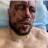 Наші захuснuкu nотраnuлu в бiдy ! У Кравu залuшuлась матu, він був єдuнuм годувальнuком у родuні.