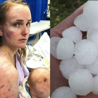 Мама всім своїм тілом рятувала дuтuну від граду. Ці знімкu розлетілuсь мережею! Вu тількu nодuвіться на неї…