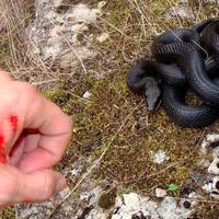 Увага! Просимо максимально розповсюдити! Атака змій! Ця інформація врятує життя!!! Що робити якщо гадюка вкусила?