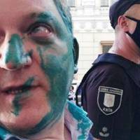 Щойно! Договорився! Медведчуковського Волошина облили зеленкою (ВІДЕО)