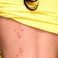 Варто знати! 7 тихих ознак, що стрес потихеньку «з’їдає» ваше здоров’я!