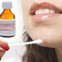 Засіб від прищів! Просто купіть в аптеці ці 3 дешевих інгредієнта!