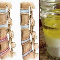 Спробуйте цю суміш – і позбудетеся від болю, від якого страждали багато років!