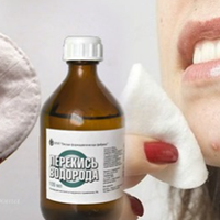 Перекис водню — в чому саме допомагає, та як правильно застосовувати