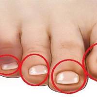 Перша ознака хвороби серця: для початку торкнися пальців на ногах…