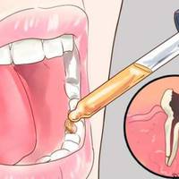 Ось як зняти будь-який зубний біль усього за кілька секунд