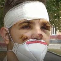 “Мамо”. Я ночі не сплю. Просто не можу “: Єдиний вцілілий в авіатрощі Ан-26 курсант розповів про останній політ та перші хвилини після трагедії