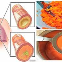 Домашній рецепт сиропу, який видаляє мокротиння з легень і виліковує від кашлю!