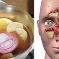 Ось справжня бомба для закладеного носа! Через добу точно все пройде!