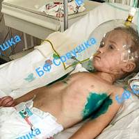 “У дитини 20 хвили не билося серденько.” Медики у Дніпрі рятують 3-річного хлопчика, у якого діагностували СОVID-19