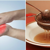 Якщо німіють пальці на руках і ногах, вам допоможуть ці натуральні засоби.