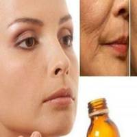 У моєму будинку вся сім’я вмивається цим кожен день! Позбудьтеся плям і зморшок!