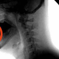 Дуже смачна отрута, яку дітям давати ні в якому разі не можна! Цього ви не знали!