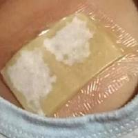 Цей засіб лікує сильний кашель і всього за ніч виводить весь слиз з легень!