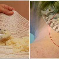 Суміш, яка виведе солі з шийної ділянки хребта, та позбавить болю!