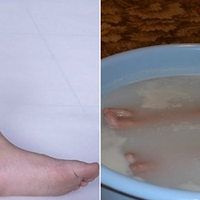 Дієвий засіб від болю в ногах. Одна ванночка перед сном, і спите спокійно