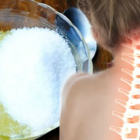 Простий засіб, який витягне солі з шийного відділу і позбавить остеохондрозу.