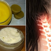 П’ять рецептів ефективної мазі від остеохондрозу, які можна приготувати вдома