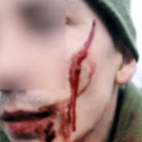 Геройський вчинок у зоні проведення ООС: солдат Герман знешкодив і затримав представника російсько-окупаційних військ