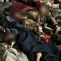 Лежать на підлозі й слухають, як по них б'ють ракети: моторошні фото поранених з 