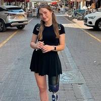 «Нога живе своїм життям». Руся Данілкіна розповіла про болі, які відчуває після ампутації